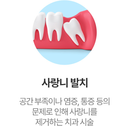 사랑니 발치