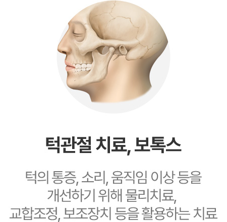 턱관절 치료, 보톡스