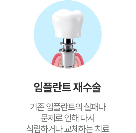 임플란트 재수술