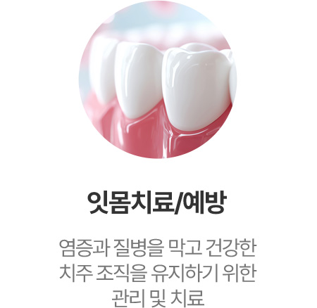 잇몸치료/예방