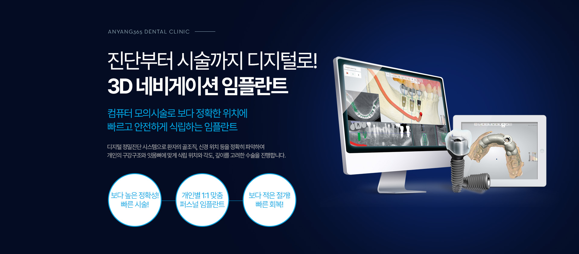 진단부터 시술까지 디지털로! 3D 네비게이션 임플란트