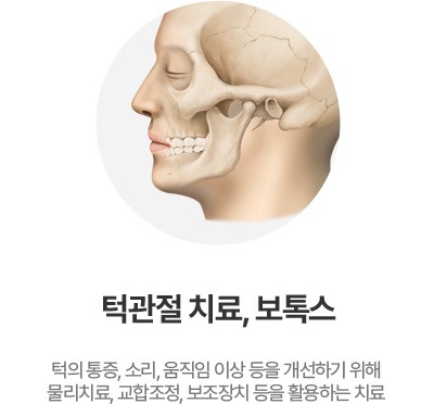 턱관절 치료, 보톡스