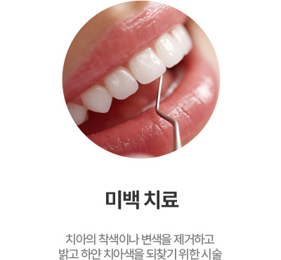 미백 치료