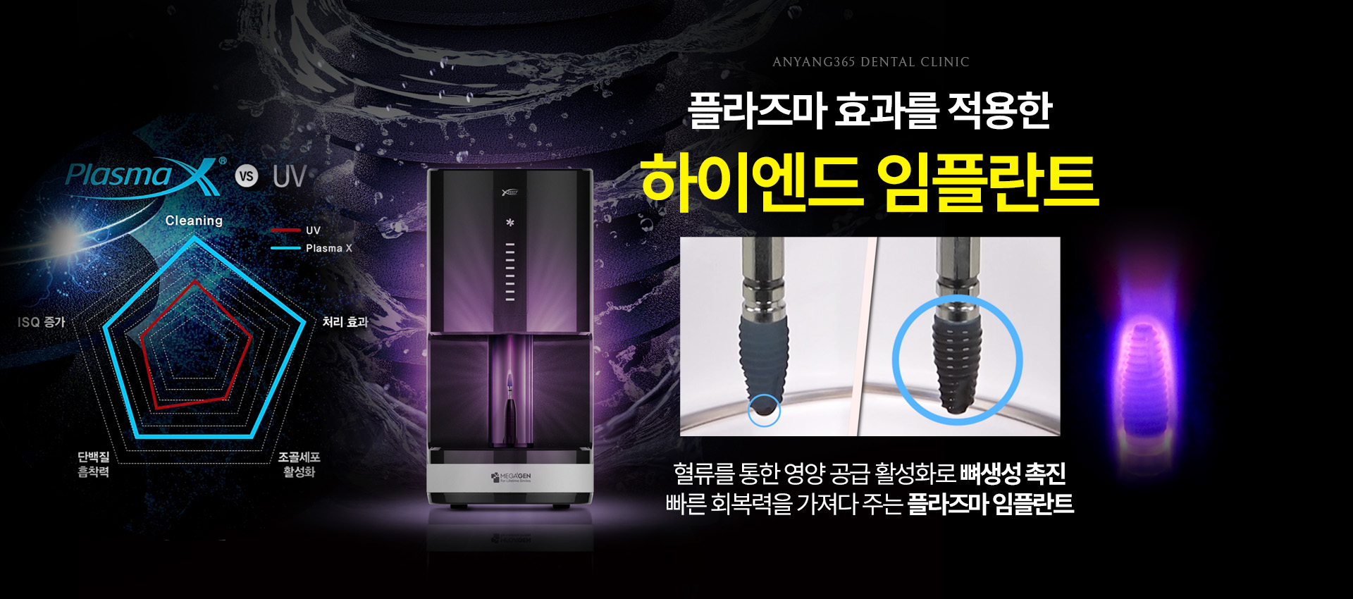 플라즈마 효과를 적용한 하이엔드 임플란트